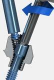 Straight abutments: Tighten the abutments to 30 Ncm using a calibrated torque wrench and the 4mm square hex adapter.