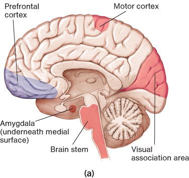 LP 3A sleep deprivation 7 Sleep and the Brain During REM sleep: the frontal lobes (planning