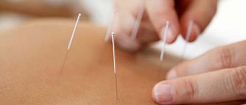 Therapies and treatments Acupuncture This treatment works to restore and maintain the body s natural balance by stimulating it s own healing response.
