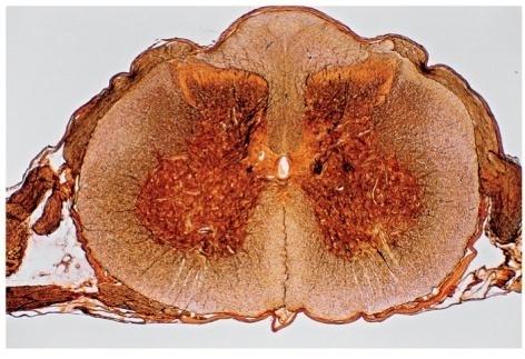 nerve Posterior root ganglion Spinal nerve Anterior median fissure Anterior root of spinal nerve Figure 13.