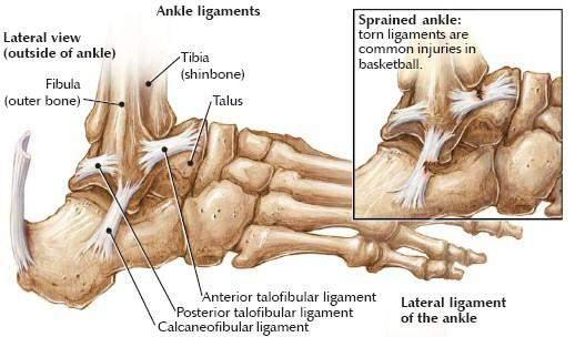 ANKLE SPRAINS Anatomy of Ankle