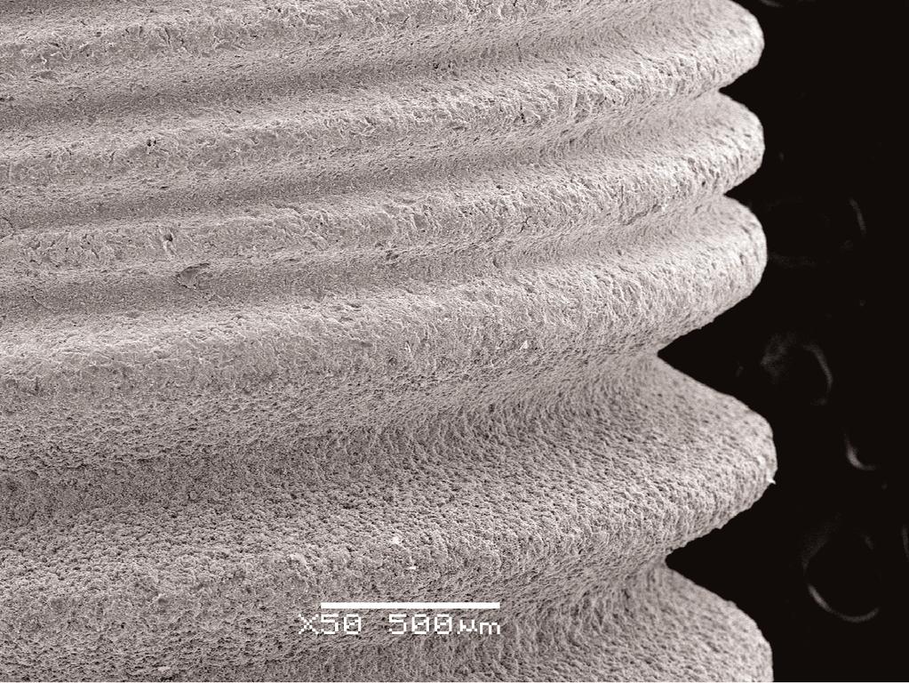 ID Taper SBM and SBActive Surface Options SBM surface is created by using a Soluble Blast Media of Hydroxylapatite (HA) crystals to create a medium-rough texture.