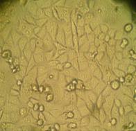 gymnorhiza can induce apoptosis of HeLa cells (Fig. 3).