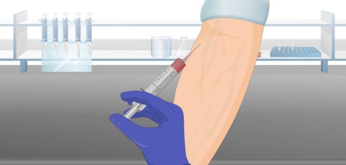 Using a sterilized needle and syringe, take out blood from the B blood group