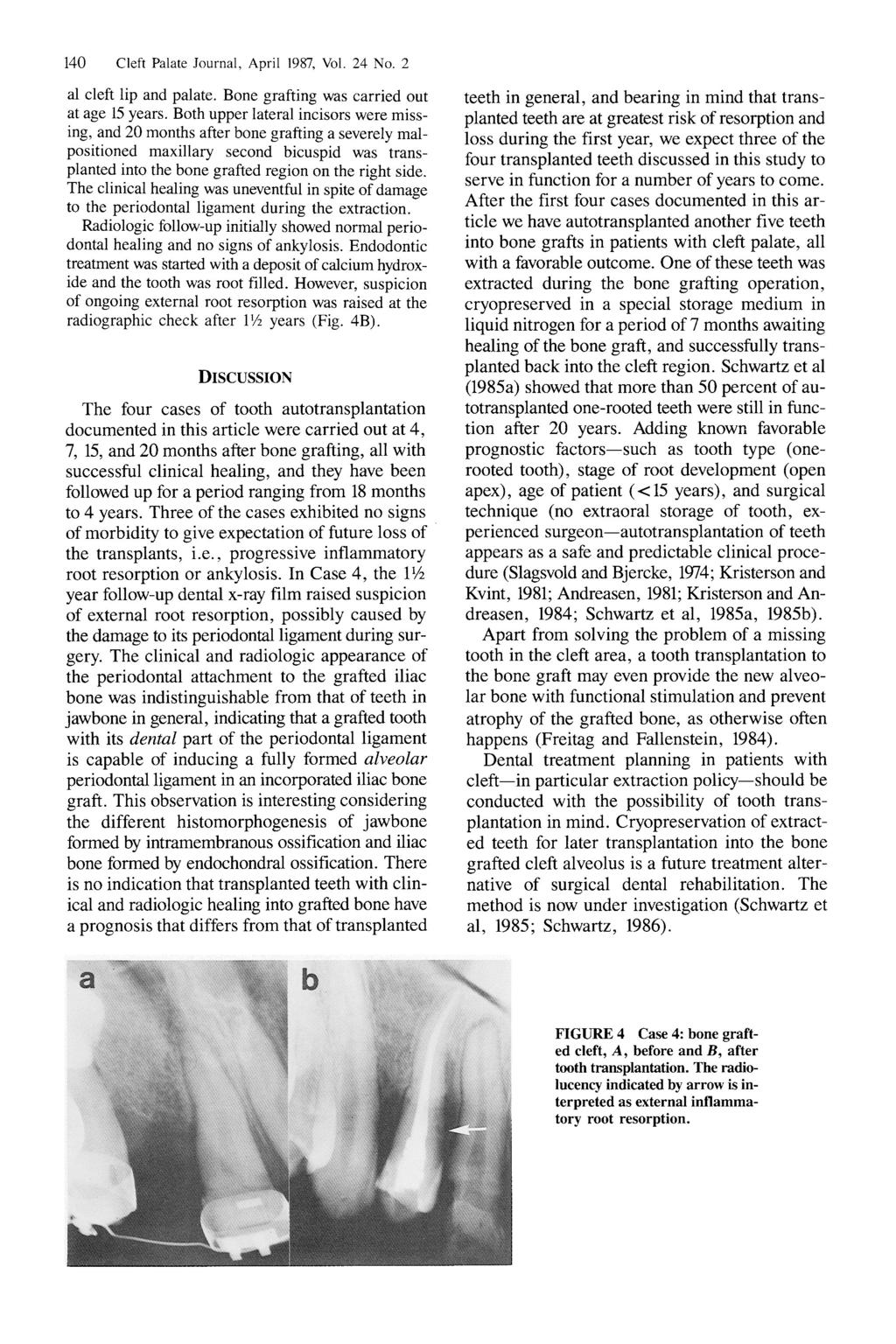 140 Cleft Palate Journal, April 1987, Vol. 24 No. 2 al cleft lip and palate. Bone grafting was carried out at age 15 years.