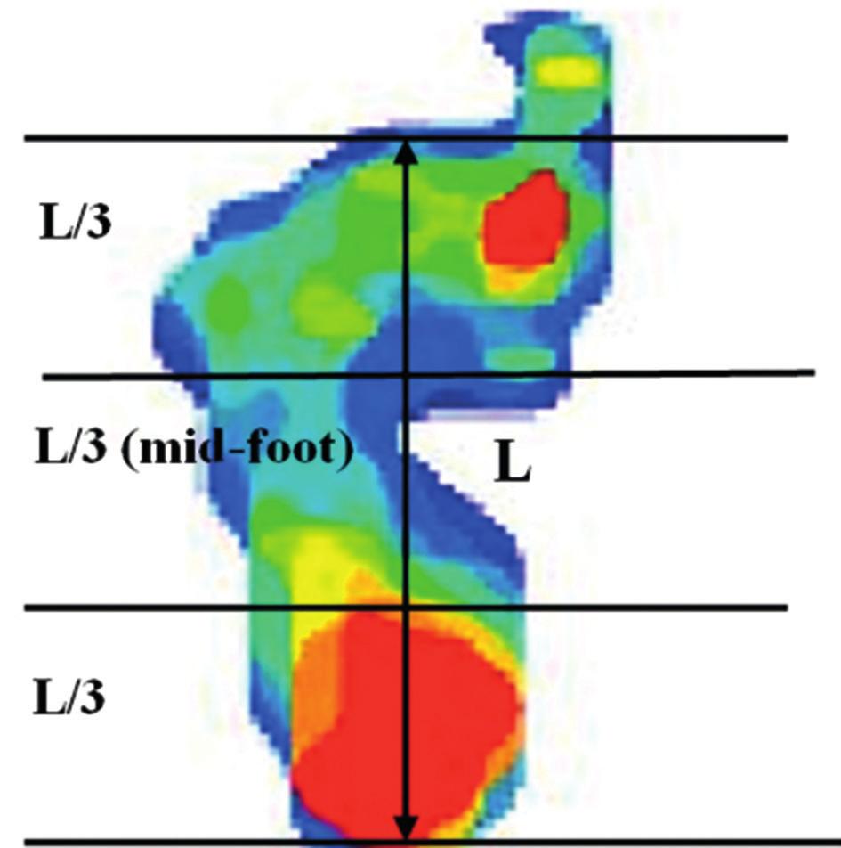 740 e. m. elmoatasem, m. a. eid Fig. 4. Pressure Mapping Scan Image. The point of the second toe and the mid-heel joined together to form (L) the length of footprint, excluding the toes.