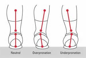 Overpronation Combined ankle eversion, abduction,