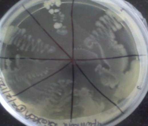 Isolation of Pure Colony: Figure 2 The bacteria with rod shape