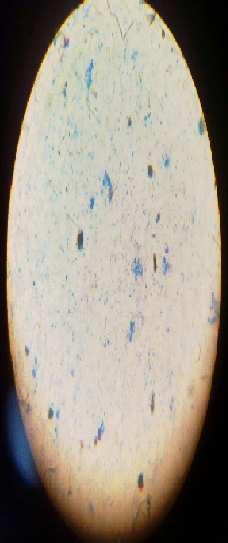 stained Bacilli were observed, showing that the bacteria is