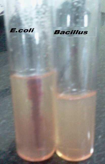Motility test: Figure 8 In glucose broth, there was color change from red to yellow and no bubble