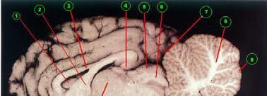 lateral ventricle 8. arbor vitae 15. mammillary body 2. fornix 9. cerebellar cortex (grey matter) 16. hypothalamus 3. corpus callosum 10.