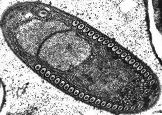 Microspora No mitochondria No microtubules