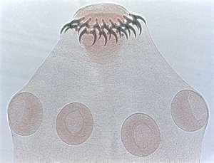 Cestodes Tapeworms Three body