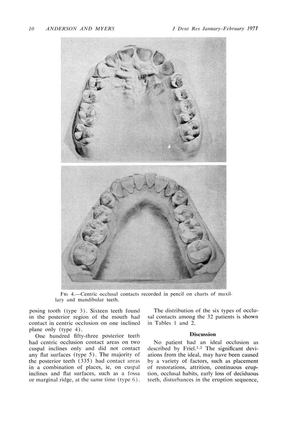 / ANDERSON ANI) MYERSl J Dent Res January-l"cbruary 7971..... AC't 9 F(; 4. Centric occlhsal contacts lairy and mandibular teeth. posing tooth (type 3).