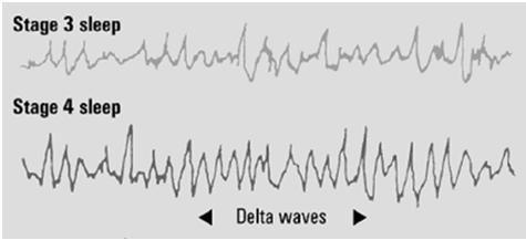 A person who is daydreaming shows theta activity.