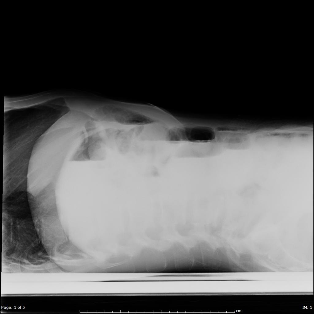 Fig. 5: Lateral abdominal radiograph shows distension of
