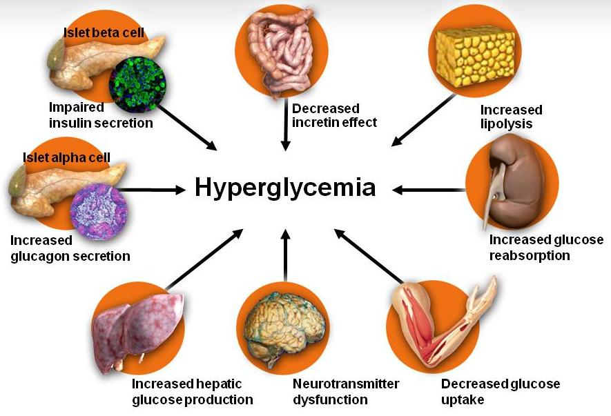Progressive β-cell Dysfunction Is a Key Driver of Progressive Dysglycemia in T2D Deteriorating β-cell function is partially driven by the incretin defect By the time of diabetes onset, up to 8% of