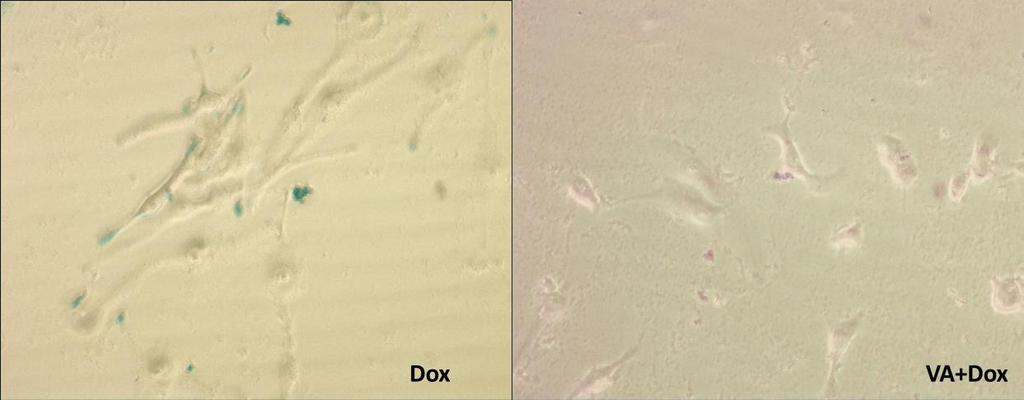 senescentni fenotip. Suprotno tome, ćelije tretirane sa VA-Dox kombinacijom ne pokazuju senescentni fenotip (Slika 4.3.