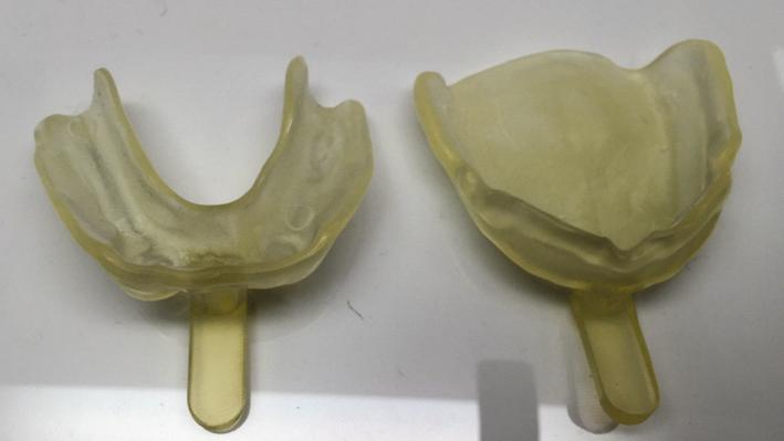 fabricated, which then are scanned for the digital design of the occlusal rims (Figure 4).