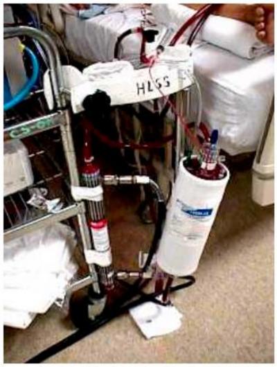 Figure 9 Image 5: Oxygenator and heat exchanger As the blood leaves the pump it enters the membrane oxygenator.