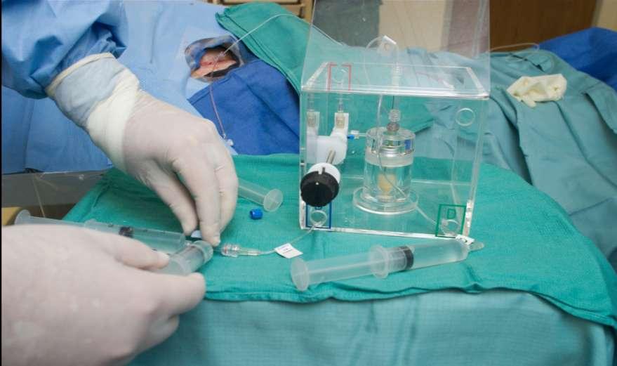 Implantation Procedure: Start IR works B line, AU Works D line Spheres
