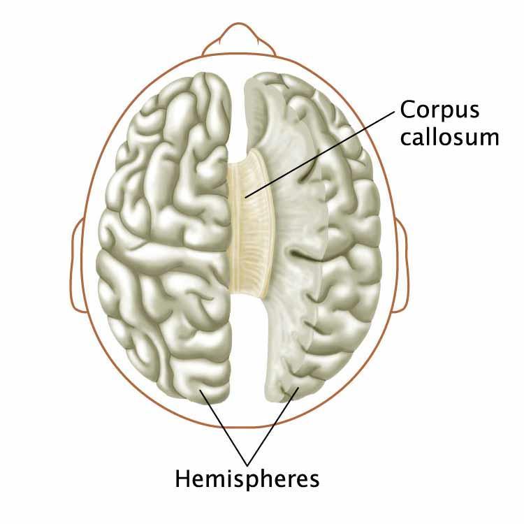 Corpus Collosum Location Bundle of nerves which connects the cerebral hemispheres