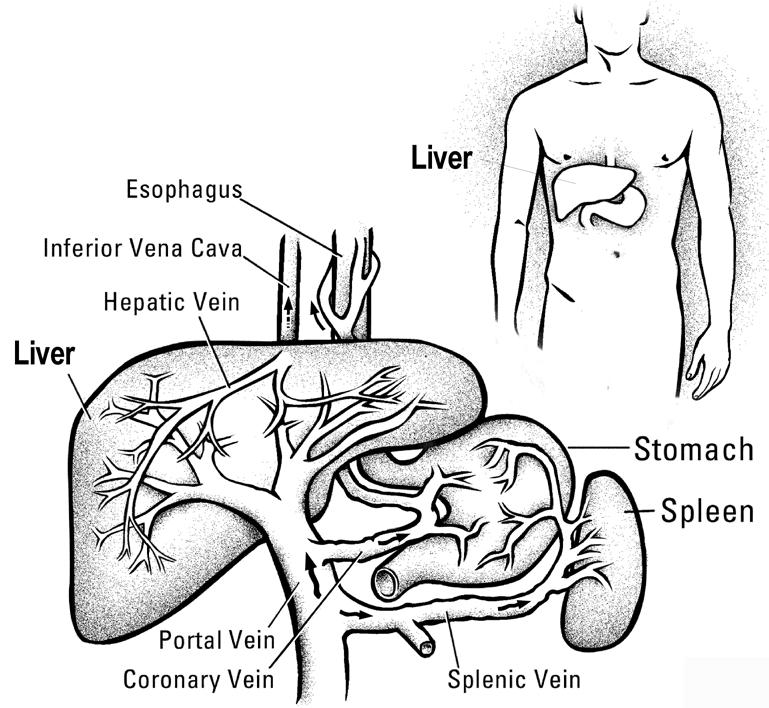filters through the liver tissue and drains into the hepatic veins and then into the heart. This drawing shows the liver, its veins, and the nearby organs. Why do I need a TIPS procedure?
