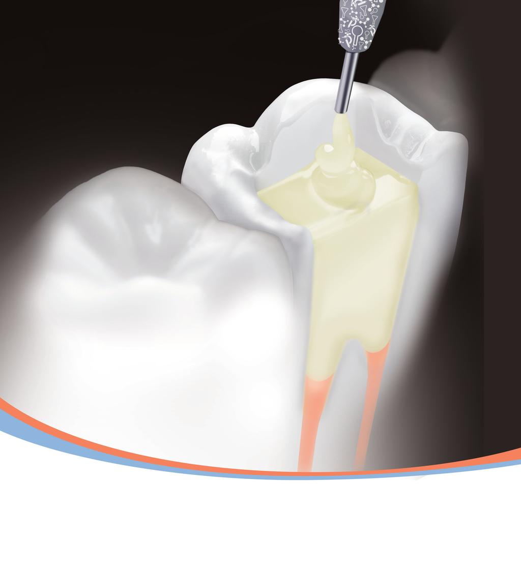 R R SDR has proven reliability in high C-factor cavities 2 SDR was introduced