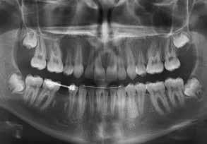 COURSE 4: Management of the Dentition This course describes the management and correction of specific dental problems involving each tooth, and corresponds to the textbook, Orthodontic Management of