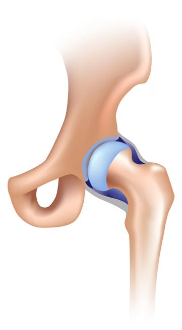 INTRODUCTION THE HIP The hip is a ball-and-socket joint. The socket is formed by the acetabulum, which is part of the pelvic bone.
