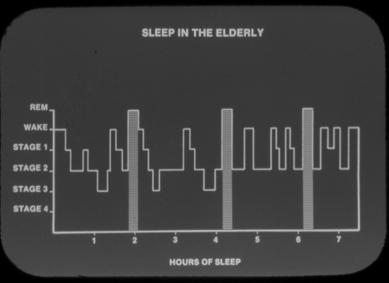 Consequences of Sleep Deprivation give hints as to the function of sleep Consequences of Sleep