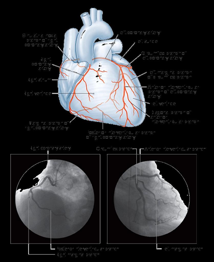 Right Coronary A. arises from right aortic sinus runs along the coronary sulcus to reach the diaphragmatic surface Left Coronary A.