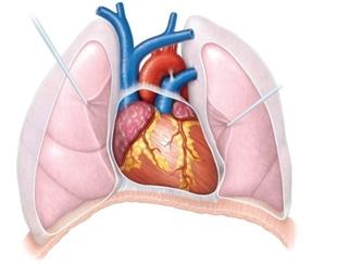 Location of the Heart in the Thorax Midsternal line Rib 2 Diaphragm Parietal pleura (cut)
