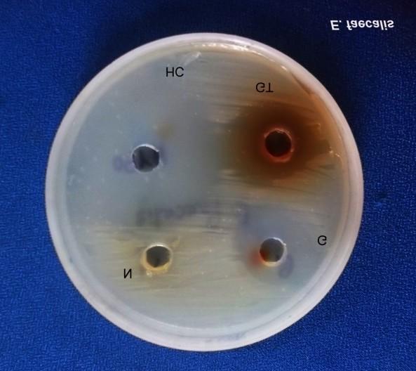 Fig.2 Culture plates showing zones of inhibition against Enterococcus faecalis Green tea extracts showed superior antibacterial activity against the E. faecalis than neem extract and garlic extract.