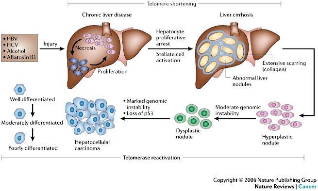 Pathogenesis of HCC Farazi and DePinho Nature Reviews Cancer 2006 Patients with HCC also have Liver cirrhosis and are more likely to die of