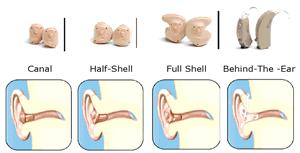 Assistive Listening Devices Hearing Aids Amplify specific frequencies