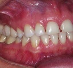teeth indicated absence of pathology,