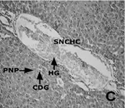 1.C has been revealed, that cellular degeneration, severe necrosis in hepatocytes, nuclear fragmentation, nuclear degenerative changes, binucleated condition, pushing of nucleus to periphery of