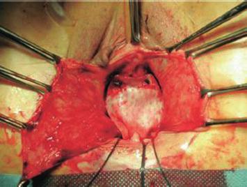 The role of biologics in pelvic floor surgery M. Ahmad et al.