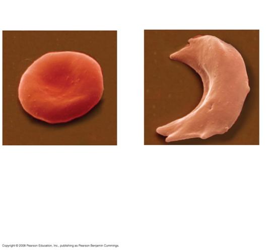 Fig. 22c 10 µm 10 µm Normal red blood cells are full of individual hemoglobin molecules, each carrying oxygen. Fibers of abnormal hemoglobin deform red blood cell into sickle shape.