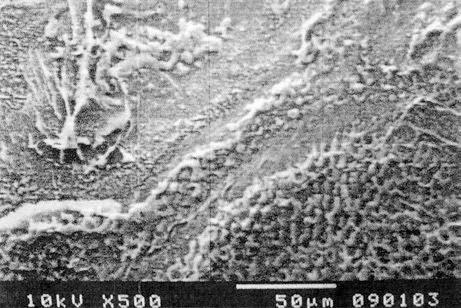 Fig. 3 500 SEM photograph of enamel etched with 35 % phosphoric acid for 15 s (no NaOCl was used). Observe type 3 etching pattern (Courtesy: Dr. R. Espinosa, Universidad de Guadalajara, Mexico) 12.