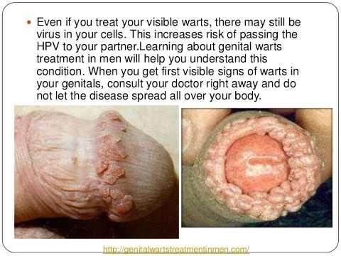 Lead to certain cancers Skin to skin Very common Flesh colored bumps Feet, vagina, vulva, cervix, penis, anus,