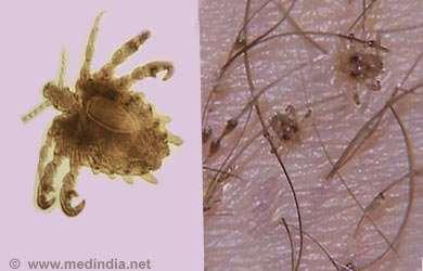 Insects Pubic lice tiny insects that attach themselves to skin and hair