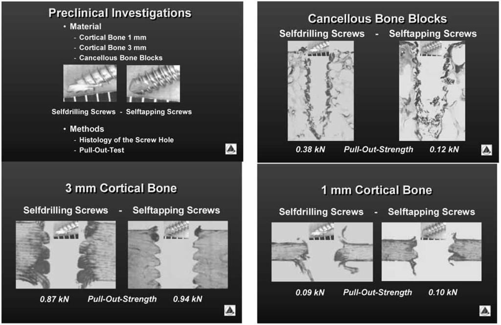 Keio J Med 2003; 52 (2): 120 127 121 Fig. 1 Retention in cortical and cancellous bone. Fig. 2 Screw loosening.