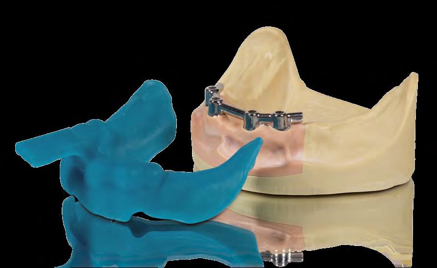 SMART MATERIAL SELECTION VarseoWax Tray The resin for 3D printing of individual impression trays VarseoWax Tray is water- and solvent-resistant during processing The printed objects