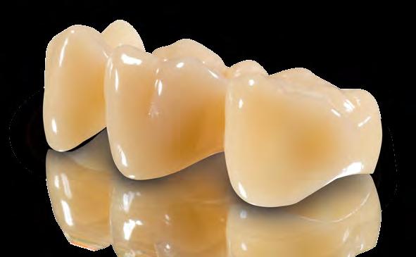 for excellent crossbatch quality standards of the product Biocompatibility confirmed by an independent institute means safety for patients VarseoSmile Dent satisfies the requirements
