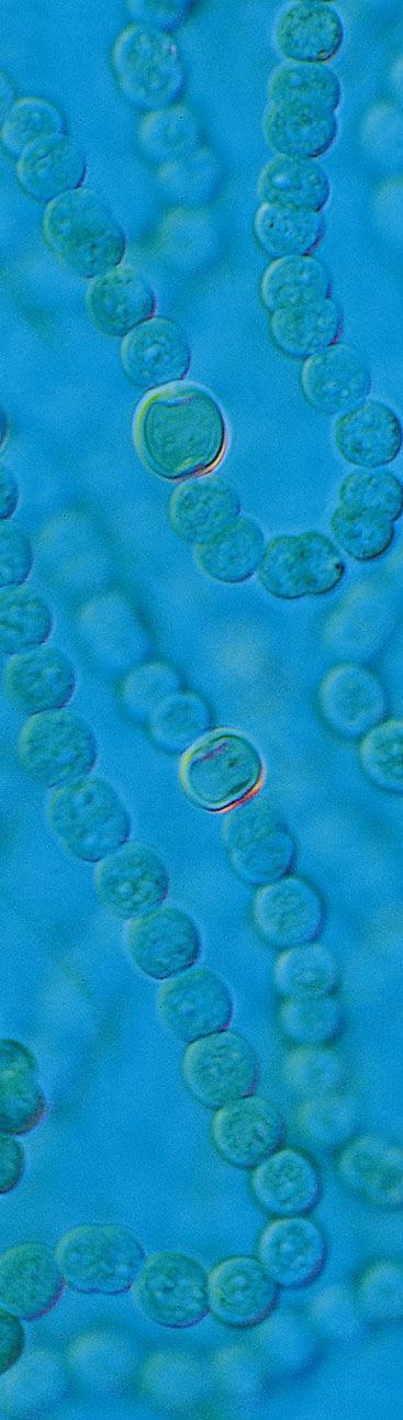 ! Prokaryotes contain a single chromosome with only a few proteins.