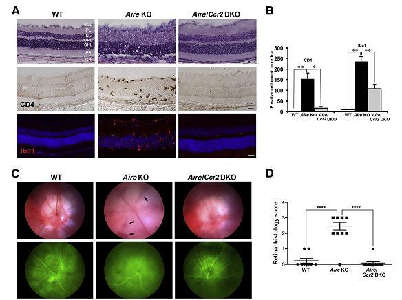 AIRE mice get spontaneous panuveitis due to loss of self-tolerance When crossed into C-C chemokine receptor 2 KO mice,