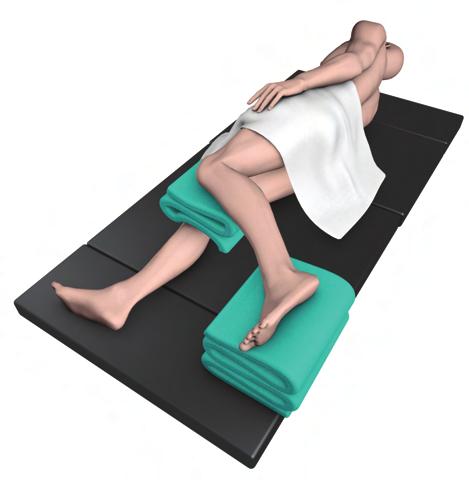 Surgical Technique Patient Positioning Place the patient in the lateral decubitus position on a radiolucent table with the affected limb flexed away from the unaffected limb.