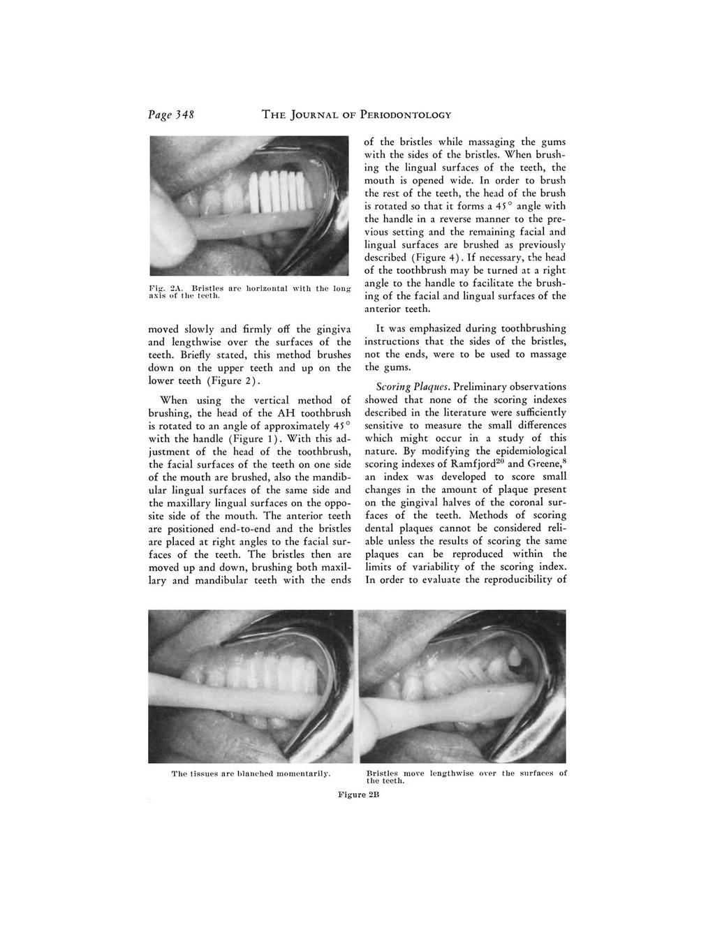 Page 348 THE JOURNAL OF PERIODONTOLOGY Fig. 2A. Bristles are horizontal with the longaxis of the teeth. moved slowly and firmly off the gingiva and lengthwise over the surfaces of the teeth.